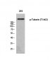 Tuberin (phospho Thr1462) Polyclonal Antibody